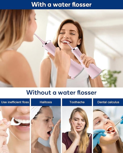 MySmile LP211 irrigador dental (Rosa)
